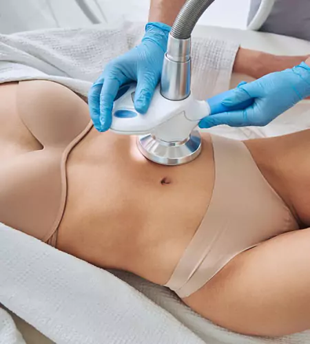 Laser Lipolysis